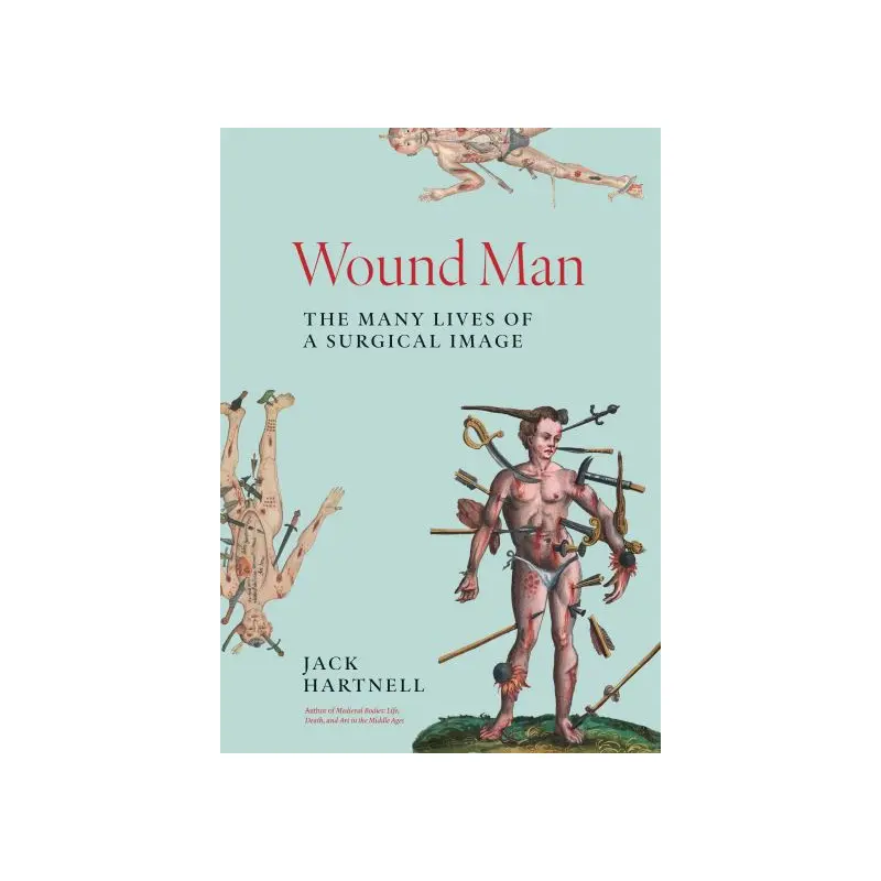 Wound Man